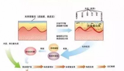 什么是干敏?什么是油敏?什么是激素敏??