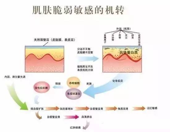 什么是干敏？什么是油敏？什么是激素敏？？