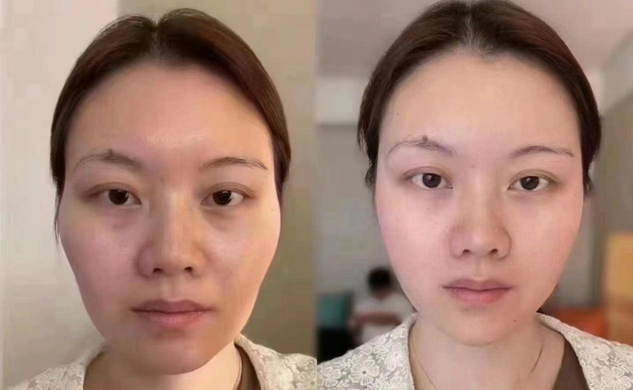 抗皱用什么产品好？听劝，跟着买拿捏皱纹、垮脸！
